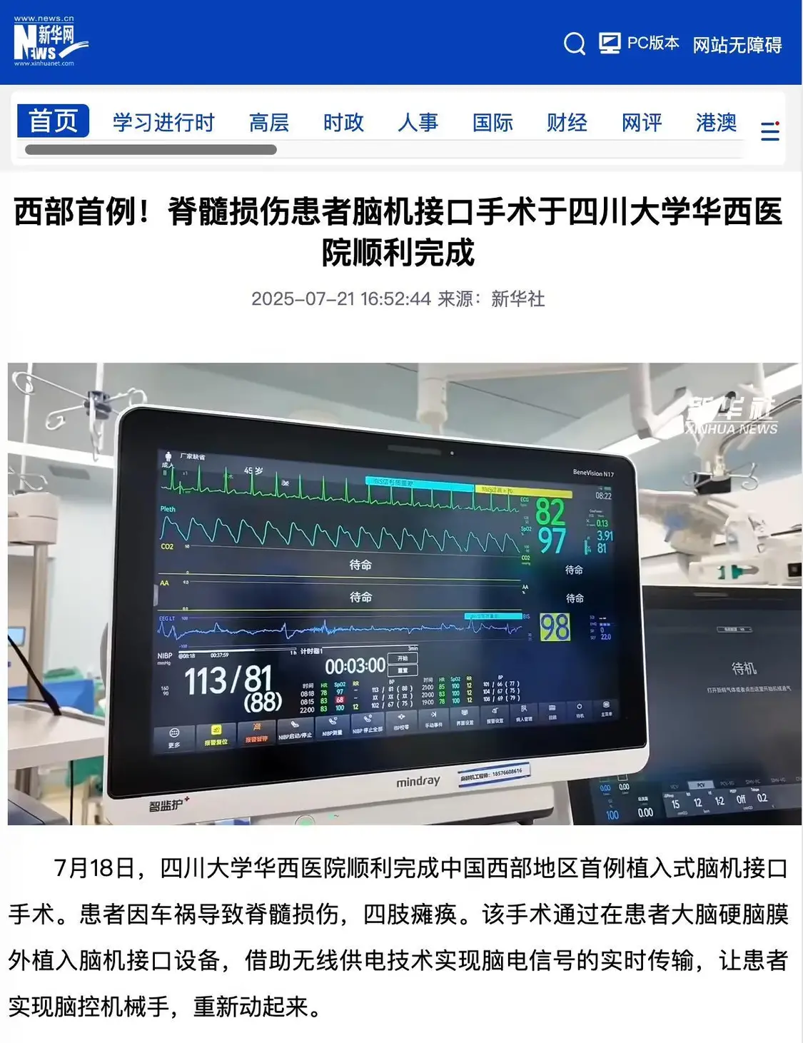 西部首例:四川大學華西醫(yī)院順利完成脊髓損傷患者腦機接口手術,可腦控機械手